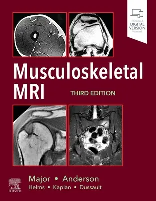 Muskuloskelettale MRT - Musculoskeletal MRI