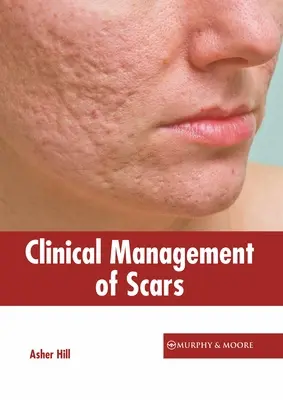 Klinisches Management von Narben - Clinical Management of Scars