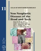 Nicht-neoplastische Erkrankungen von Kopf und Hals - Non-Neoplastic Diseases of the Head and Neck