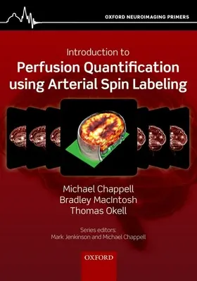 Einführung in die Perfusionsquantifizierung mit Hilfe des Arterial Spin Labelling - Introduction to Perfusion Quantification Using Arterial Spin Labelling