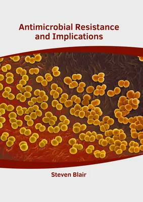 Antimikrobielle Resistenz und ihre Auswirkungen - Antimicrobial Resistance and Implications