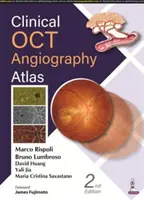 Klinischer OCT-Angiographie-Atlas - Clinical OCT Angiography Atlas