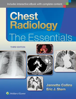 Radiologie des Brustkorbs: Das Wesentliche - Chest Radiology: The Essentials