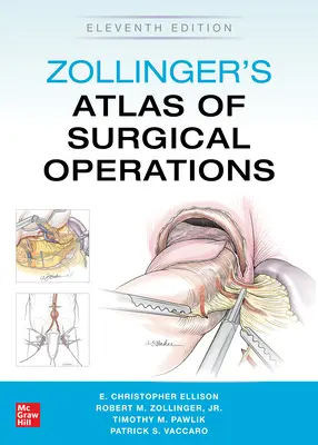 Zollingers Atlas der chirurgischen Operationen, elfte Auflage - Zollinger's Atlas of Surgical Operations, Eleventh Edition
