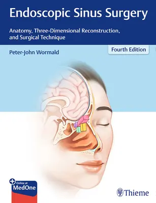 Endoskopische Sinus-Chirurgie: Anatomie, dreidimensionale Rekonstruktion und chirurgische Technik - Endoscopic Sinus Surgery: Anatomy, Three-Dimensional Reconstruction, and Surgical Technique