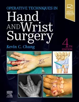 Operative Techniken: Hand- und Handgelenkschirurgie - Operative Techniques: Hand and Wrist Surgery