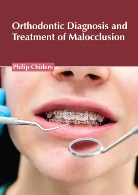 Kieferorthopädische Diagnose und Behandlung von Malokklusion - Orthodontic Diagnosis and Treatment of Malocclusion