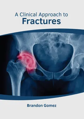 Ein klinischer Ansatz für Frakturen - A Clinical Approach to Fractures
