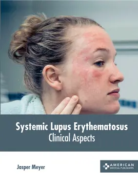 Systemischer Lupus Erythematosus: Klinische Aspekte - Systemic Lupus Erythematosus: Clinical Aspects