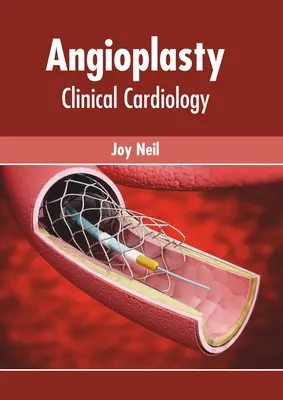 Angioplastie: Klinische Kardiologie - Angioplasty: Clinical Cardiology