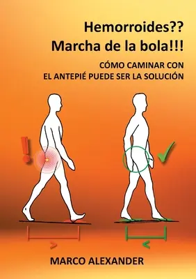 Hemorroides? Marcha de la bola!: Cmo caminar con el antepi puede ser la solucin