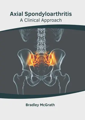 Axiale Spondyloarthritis: Eine klinische Annäherung - Axial Spondyloarthritis: A Clinical Approach