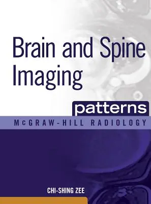 Bildgebende Verfahren für Gehirn und Wirbelsäule: Bildgebung des Gehirns und der Wirbelsäule - Brain and Spine Imaging Patterns: Brain & Spine Imaging