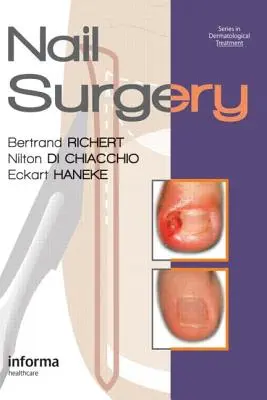 Nagelchirurgie - Nail Surgery