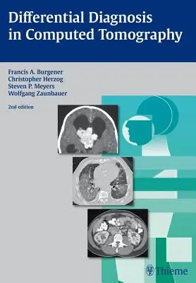 Differenzialdiagnose in der Computertomographie - Differential Diagnosis in Computed Tomography