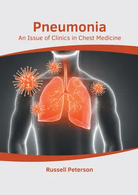 Lungenentzündung: Eine Ausgabe von Clinics in Chest Medicine - Pneumonia: An Issue of Clinics in Chest Medicine