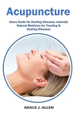 Akupunktur: Benutzerhandbuch für die Heilung von Krankheiten natürlich natürliche Medizin für die Behandlung und Heilung von Krankheiten - Acupuncture: Users Guide for Healing Diseases naturally Natural Medicine for Treating & Healing Diseases