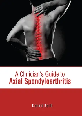 Leitfaden für Kliniker zur axialen Spondyloarthritis - A Clinician's Guide to Axial Spondyloarthritis