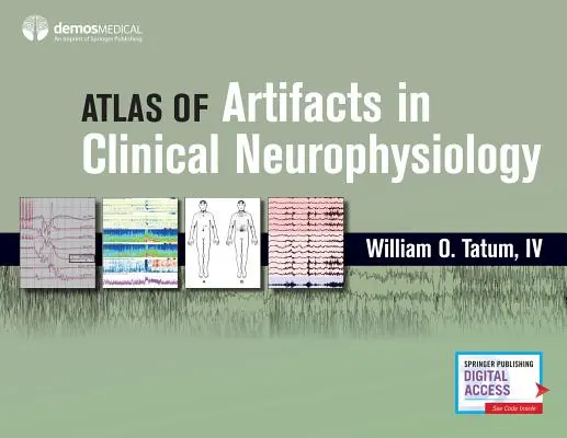 Atlas der Artefakte in der klinischen Neurophysiologie - Atlas of Artifacts in Clinical Neurophysiology