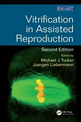 Vitrifikation in der assistierten Reproduktion - Vitrification in Assisted Reproduction