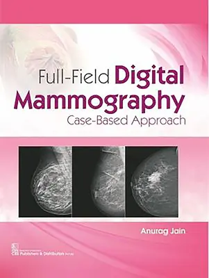 Digitale Vollfeld-Mammographie: Fallbasierter Ansatz - Full-Field Digital Mammography: Case-Based Approach