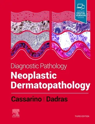 Diagnostische Pathologie: Neoplastische Dermatopathologie - Diagnostic Pathology: Neoplastic Dermatopathology