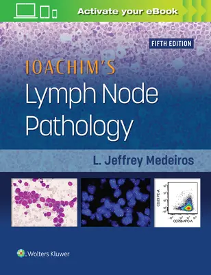 Ioachim's Lymphknoten-Pathologie - Ioachim's Lymph Node Pathology