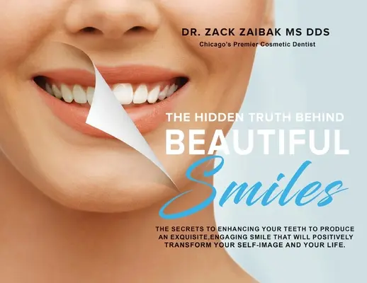 Die verborgene Wahrheit hinter dem schönen Lächeln: Die Geheimnisse der Zahnkorrektur für ein exquisites, einnehmendes Lächeln, das Ihre Persönlichkeit positiv verändern wird. - The Hidden Truth Behind Beautiful Smiles: The secrets to enhancing your teeth to produce an exquisite, engaging smile that will positively transform y