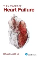 Die 4 Stadien der Herzinsuffizienz - The 4 Stages of Heart Failure