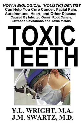 Giftige Zähne: Wie ein biologischer (ganzheitlicher) Zahnarzt Ihnen helfen kann, Krebs, Gesichtsschmerzen, Autoimmun-, Herz- und andere Krankheiten zu heilen - Toxic Teeth: How a Biological (Holistic) Dentist Can Help You Cure Cancer, Facial Pain, Autoimmune, Heart, and Other Disease Caused