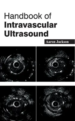 Handbuch des intravaskulären Ultraschalls - Handbook of Intravascular Ultrasound