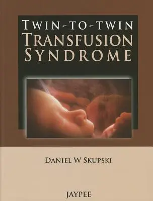 Zwilling-zu-Zwilling-Transfusionssyndrom - Twin-To-Twin Transfusion Syndrome