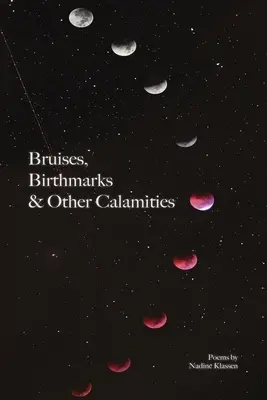 Prellungen, Muttermale und andere Kalamitäten - Bruises, Birthmarks & Other Calamities