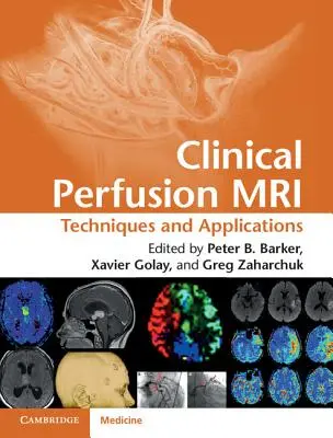 Klinische Perfusions-MRT: Techniken und Anwendungen - Clinical Perfusion MRI: Techniques and Applications