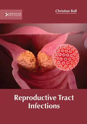 Infektionen der Geschlechtsorgane - Reproductive Tract Infections