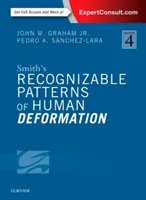 Smiths Erkennbare Muster menschlicher Verformung - Smith's Recognizable Patterns of Human Deformation