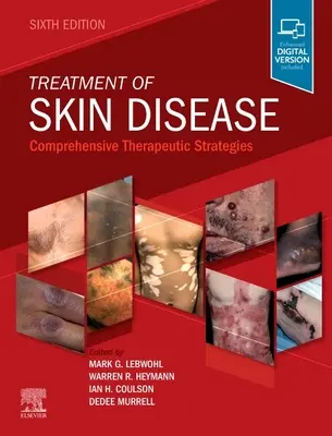 Behandlung von Hautkrankheiten: Umfassende therapeutische Strategien - Treatment of Skin Disease: Comprehensive Therapeutic Strategies