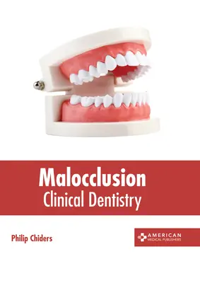 Malokklusion: Klinische Zahnheilkunde - Malocclusion: Clinical Dentistry
