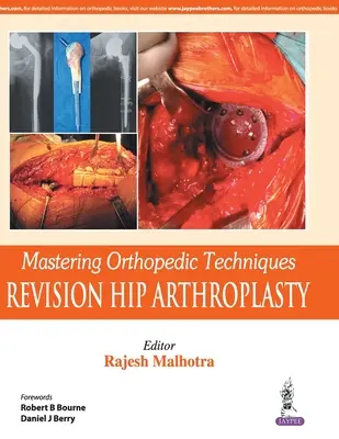 Beherrschung orthopädischer Techniken: Revision einer totalen Hüftarthroplastik - Mastering Orthopedic Techniques: Revision Total Hip Arthroplasty