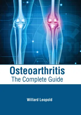 Osteoarthritis: Der vollständige Leitfaden - Osteoarthritis: The Complete Guide