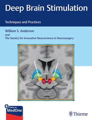 Tiefe Hirnstimulation: Techniken und Praktiken - Deep Brain Stimulation: Techniques and Practices
