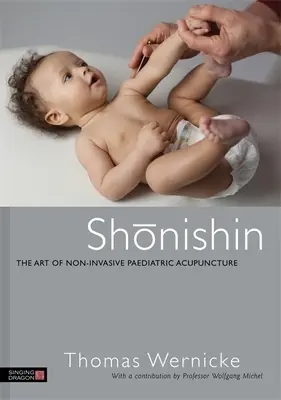 Shonishin: Die Kunst der nicht-invasiven pädiatrischen Akupunktur - Shonishin: The Art of Non-Invasive Paediatric Acupuncture