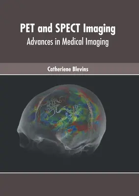 Tier- und Spektralbildgebung: Fortschritte in der medizinischen Bildgebung - Pet and Spect Imaging: Advances in Medical Imaging