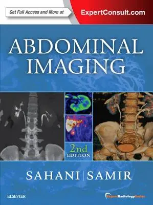 Abdominal Imaging: Reihe Experten für Radiologie - Abdominal Imaging: Expert Radiology Series