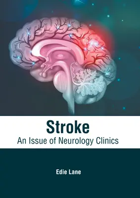 Schlaganfall: Eine Ausgabe von Neurology Clinics - Stroke: An Issue of Neurology Clinics