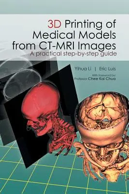 3D-Druck von medizinischen Modellen aus CT-MRI-Bildern: Eine praktische Schritt-für-Schritt-Anleitung - 3D Printing of Medical Models from CT-MRI Images: A Practical step-by-step guide