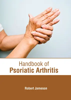 Handbuch der psoriatischen Arthritis - Handbook of Psoriatic Arthritis