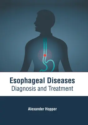Erkrankungen der Speiseröhre: Diagnose und Behandlung - Esophageal Diseases: Diagnosis and Treatment