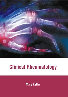 Klinische Rheumatologie - Clinical Rheumatology