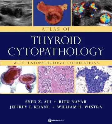 Atlas der Zytopathologie der Schilddrüse: Mit histopathologischen Korrelationen - Atlas of Thyroid Cytopathology: With Histopathologic Correlations